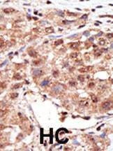 Anti-MTM1 (N-term) Antibody