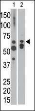 Anti-MTM1 (C-term) Antibody