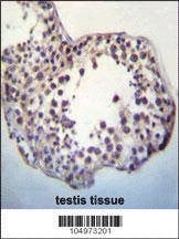 Anti-TPTEa (N-term) Antibody