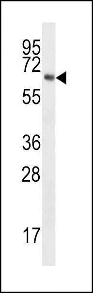 Anti-TPTEa (N-term) Antibody