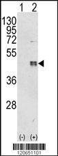 Anti-CEBPB (C-term) Antibody