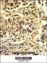 Anti-CEBPB (C-term) Antibody