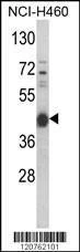 Anti-PRKACA (N-term K82) Antibody