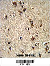 Anti-ALAD (C-term) Antibody