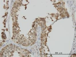 Anti-HSPA1L Antibody
