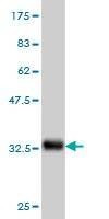 Anti-HSPA1L Antibody