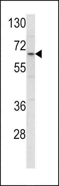 Anti-ENTH (Center) Antibody
