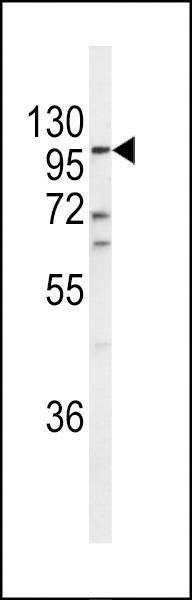 Anti-ECE-1 (C-term) Antibody