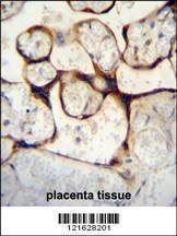 Anti-ECE1 (Center) Antibody