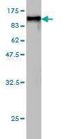 Anti-HSPA2 Antibody