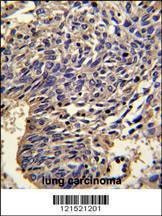 Anti-IL1A (Center) Antibody