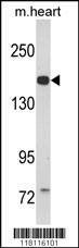 Anti-CORIN (Center) Antibody