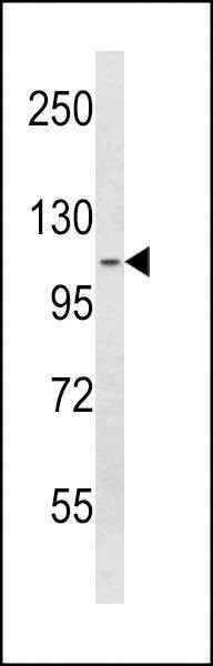 Anti-SPINK5 (N-term) Antibody