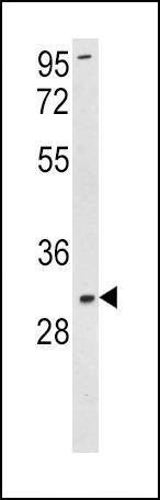 Anti-SOD3 (N-term) Antibody