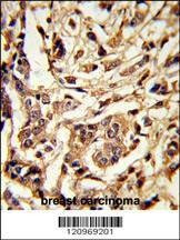 Anti-GALT (C-term) Antibody