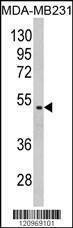 Anti-GALT (C-term) Antibody