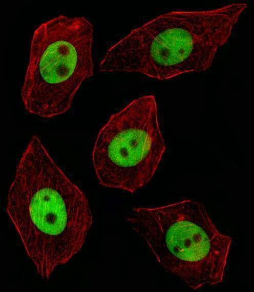 Anti-GTF2I (C-term) Antibody
