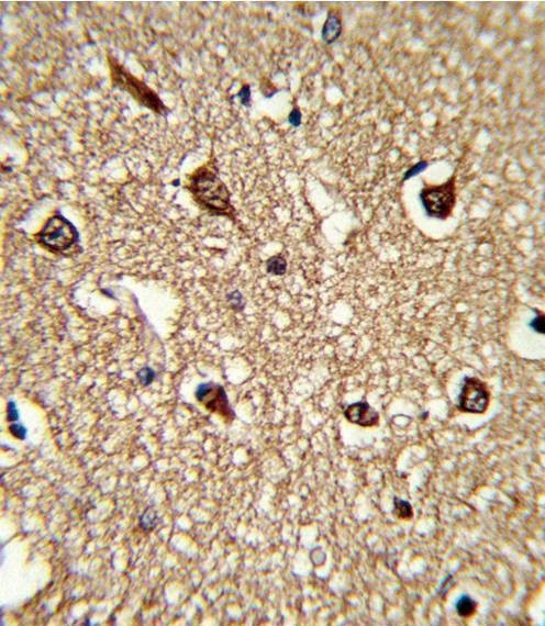 Anti-HLA-DRB1 (N-term) Antibody
