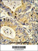 Anti-RS18 (Center) Antibody