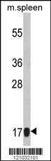 Anti-RS18 (Center) Antibody