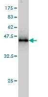 Anti-HSPB7 Antibody