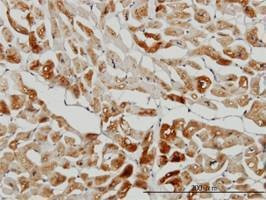 Anti-HSPB7 Antibody