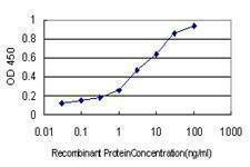 Anti-HSPB7 Antibody