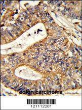 Anti-CALR (Center) Antibody
