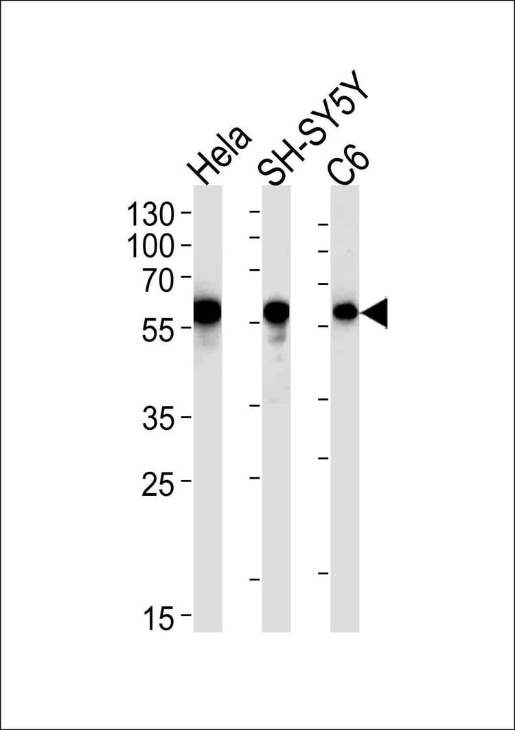 Anti-CALR Antibody