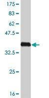 Anti-HSPB8 Antibody