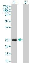 Anti-HSPB8 Antibody
