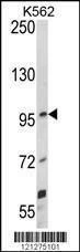 Anti-UNC5C (Center) Antibody