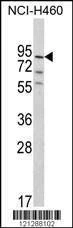 Anti-MyoGEF (N-term) Antibody