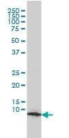Anti-HSPE1 Antibody