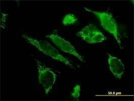Anti-HSPE1 Antibody