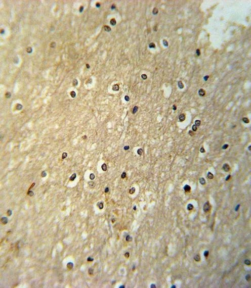 Anti-PAX6-T373 Antibody