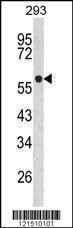 Anti-TPH1 (N-term) Antibody