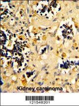 Anti-NDUFS4 (C-term) Antibody
