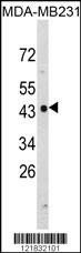 Anti-NDRG1 (N-term) Antibody