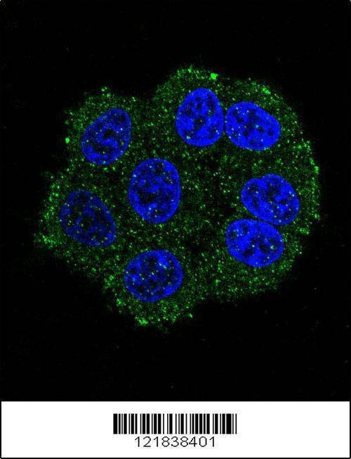 Anti-TMPRSS3 (Center) Antibody