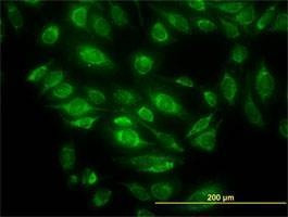 Anti-HTRA2 Antibody