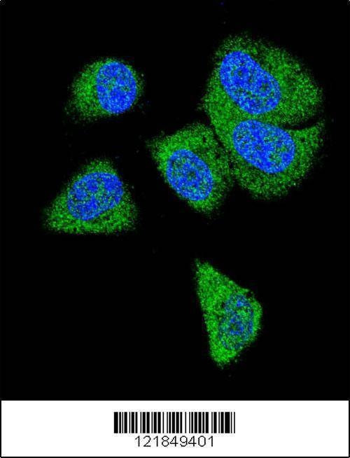 Anti-C6 (N-term) Antibody