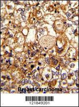 Anti-C6 (N-term) Antibody