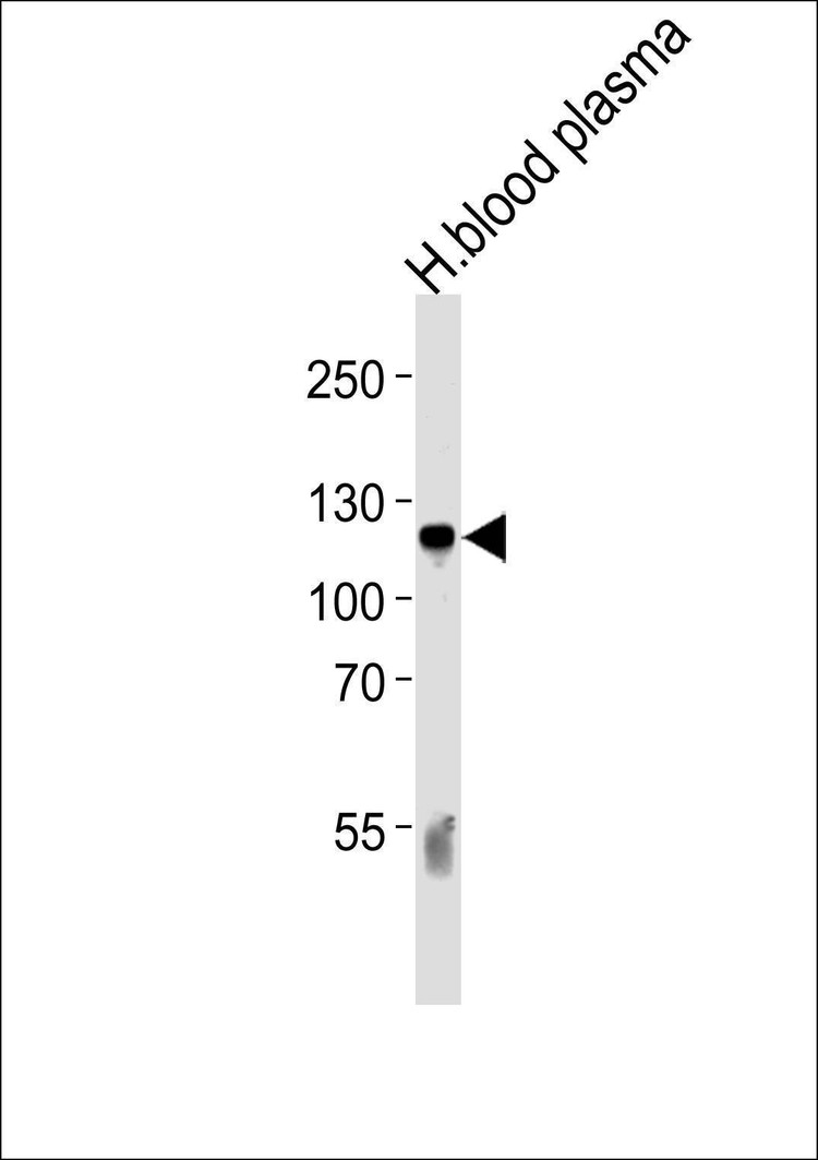 Anti-C6 (N-term) Antibody