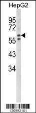 Anti-HEXA (Center) Antibody