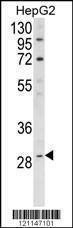 Anti-DIO1 (N-term) Antibody