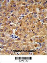 Anti-CBS (N-term) Antibody