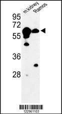 Anti-CBS (N-term) Antibody