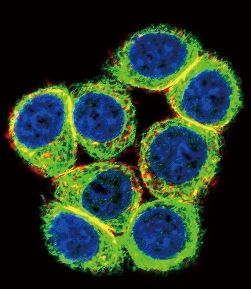 Anti-CBS (Center) Antibody