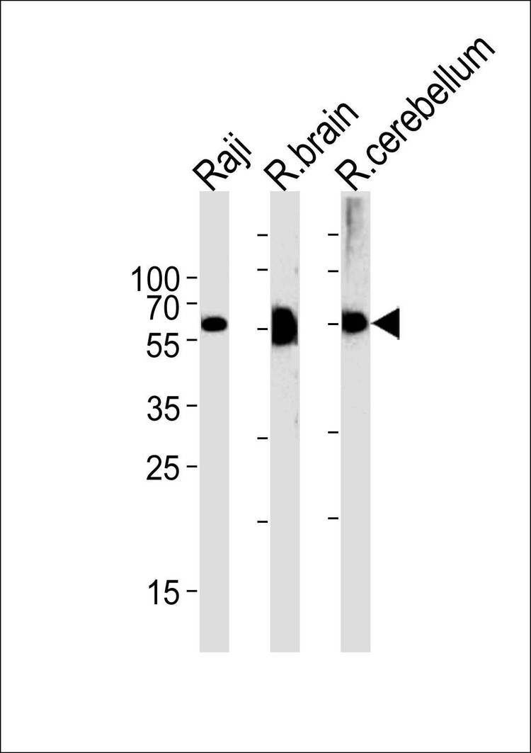 Anti-CBS (Center) Antibody